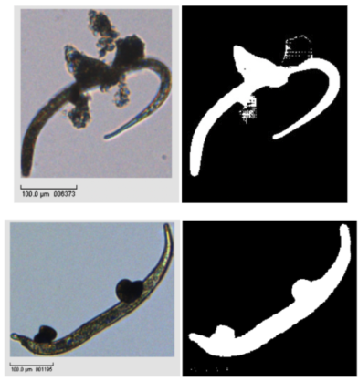 Initial microscopy images with organism–debris ambiguity and early masks